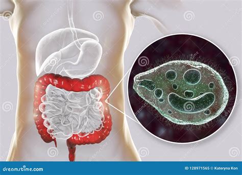 Balantidium Coli Protozoan in Large Intestine Stock Illustration - Illustration of nucleus ...