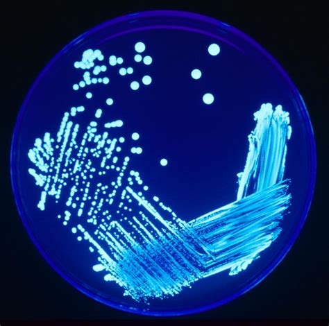 Legionella – howMed