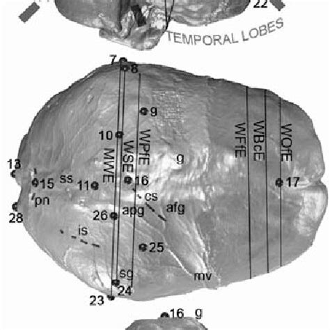 Anterolateral view of the original skull of Cro-Magnon 1; top row ...