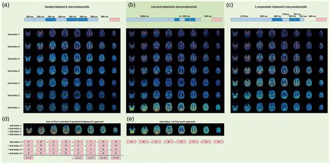 Advances in arterial spin labelling MRI methods for measuring perfusion and collateral flow ...