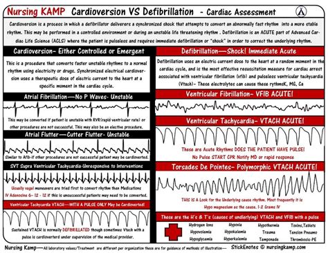 nursingkamp.com Cardiac Cardioversion VS Defibrillation Defibrillation ...