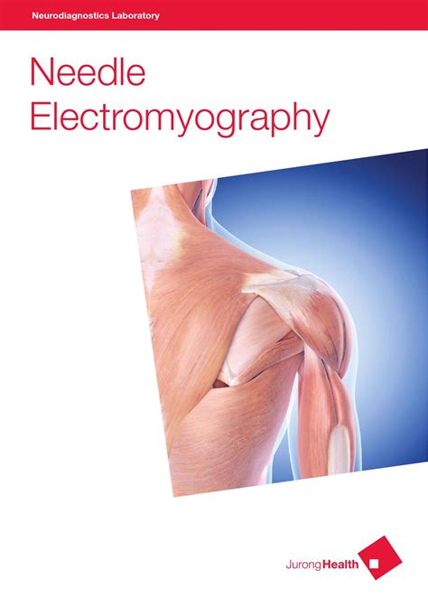 Neurodiagnostic Laboratory Services - Needle Electromyography by JurongHealth Campus - Issuu