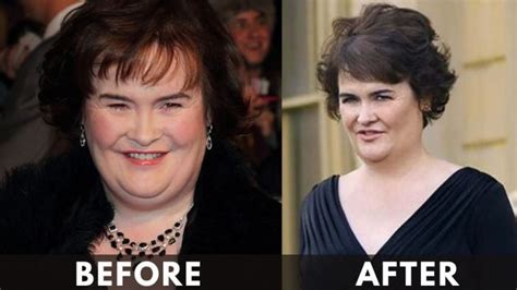 Susan Boyle Weight Loss [2024] - Before and After