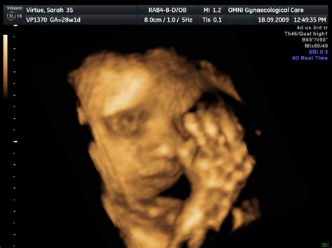 4d pregnancy scans « Us and the Bump