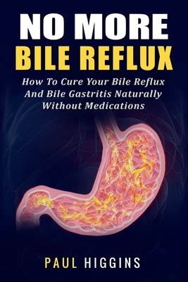 No More Bile Reflux: How to Cure Your Bile Reflux and Bile Gastritis ...