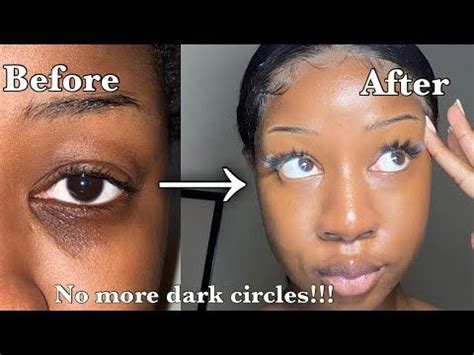 HOW I BRIGHTENED MY DARK CIRCLES!! SIMPLE AND EFFECTIVE ROUTINE ...