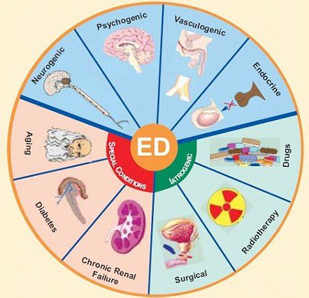 What Causes ED? — Erectile Dysfunction Clinic of Brentwood