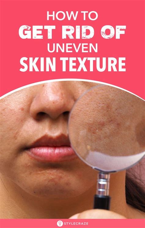 How To Get Rid Of Uneven Skin Texture - Diet Sehat