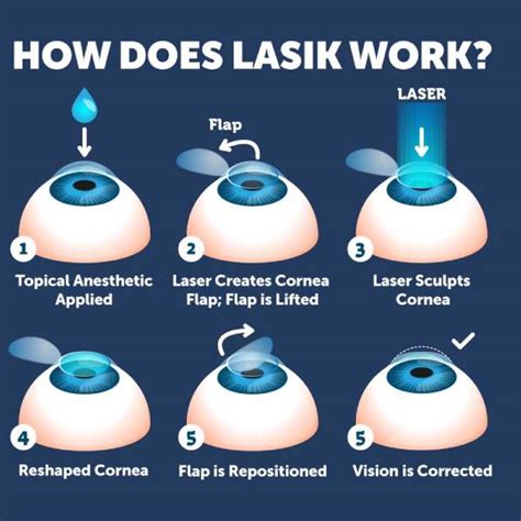 Lasik & Refractive Surgery Specialist in Dombivali | Dr. Vidya Bawkar