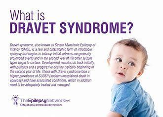 Zogenix's Medication For Dravet Syndrome Likely Delayed 12-15 Months - Zogenix, Inc. (NASDAQ ...