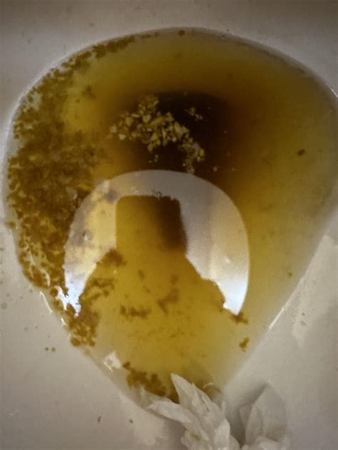 I think I have paradoxical diarrhea… but what are these bits in it? : r/poop