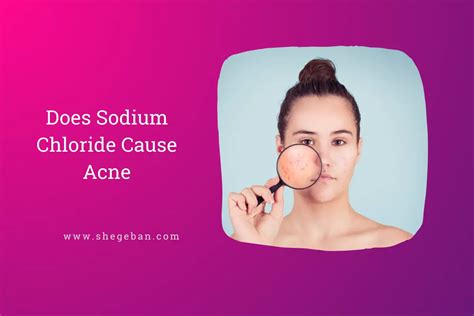 Does Sodium Chloride Cause Acne?