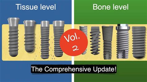 November 24, 2022 – Implant + Dentistry – Nikos Mattheos