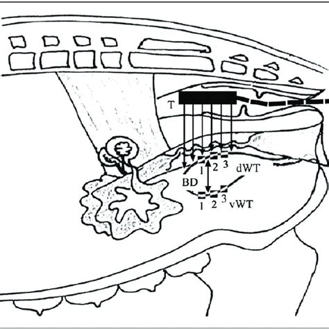 Schematic illustration of the procedure of transrectal ultrasonographic ...