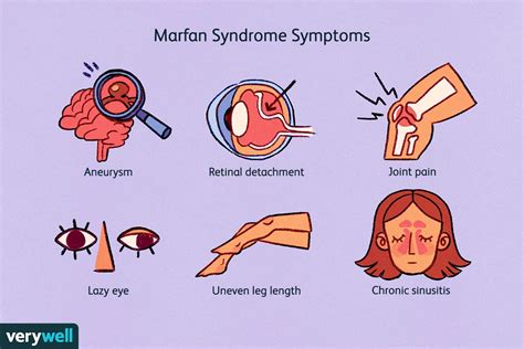 Marfan Syndrome Discovery