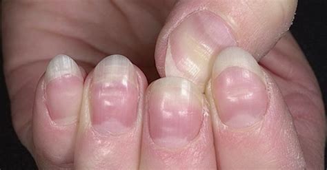 Your Nails What Say About Your Health it may be hard to believe