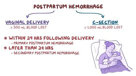 Postpartum hemorrhage: Clinical: Video & Anatomy | Osmosis