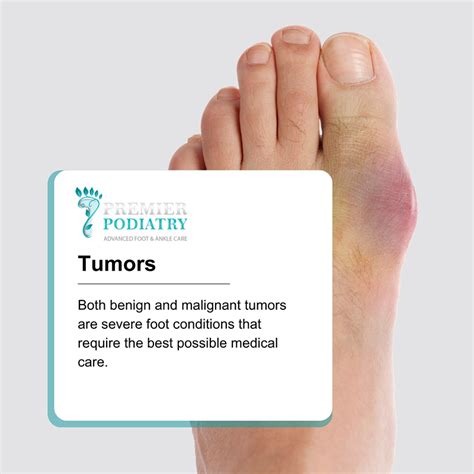 Benign and Malignant Tumors - Premier Podiatry: Velimir Petkov, DPM: Podiatrists: Clifton, NJ