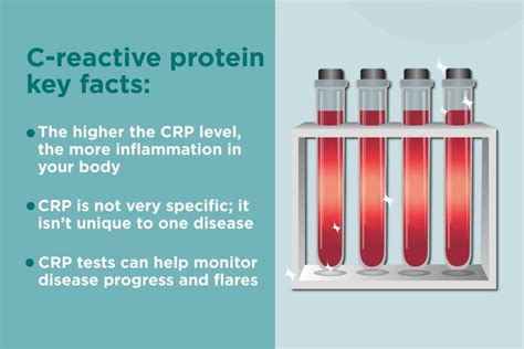 What Is C-Reactive Protein? What It Can Tell You About Your Autoimmune Disease – CreakyJoints