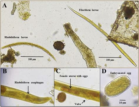 Strongyloides Stercoralis Filariform Larvae