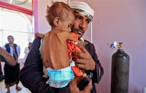 13M people at risk of starving to death in Yemen, UN warns | CBC News