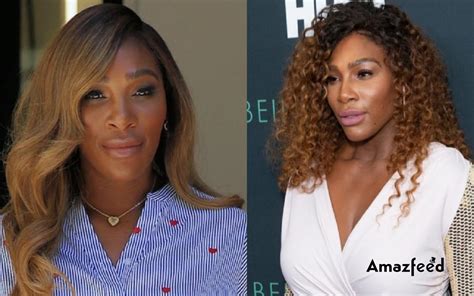 Serena Williams Plastic Surgery Before And After Look | Is Serena ...