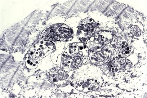 Free picture: tachyzoites, toxoplasma gondii, visible, pseudocyst, striated, myocardial, myocyte