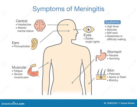 Meningitis Cartoon Vector | CartoonDealer.com #19743381