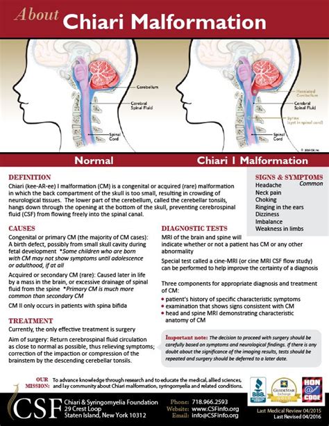 Chiari Malformation One Page Information Sheet | Chiari malformation ...