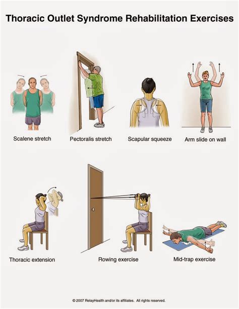 Anthony' Massage and Acupuncture Studio: Exercises for Thoracic Outlet Syndrome