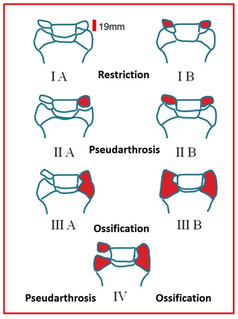 Applied Sciences | Free Full-Text | Diagnostic Limitations and Aspects of the Lumbosacral ...