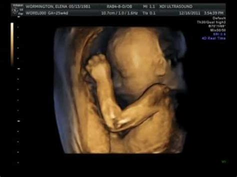 Baby Ultrasound: Baby Ultrasound Video 24 Weeks