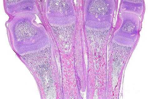 Endochondral Ossification Photograph by Jose Calvo / Science Photo ...