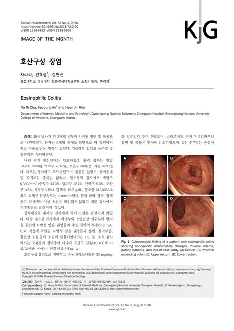 (PDF) Eosinophilic Colitis