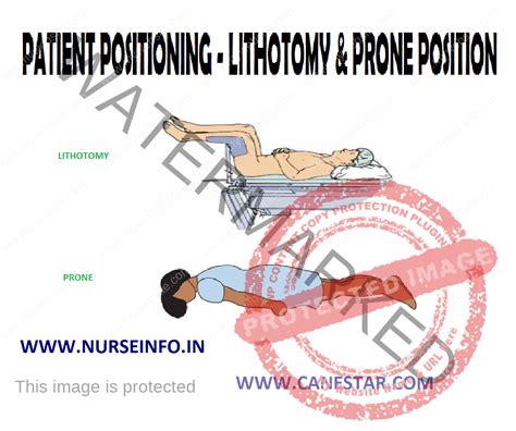 PATIENT POSITIONING – LITHOTOMY & PRONE POSITION - Nurse Info