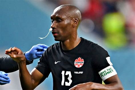 World Cup 2022: Canada MNT veteran Atiba Hutchinson uses tampon for bloody nose midgame | Marca