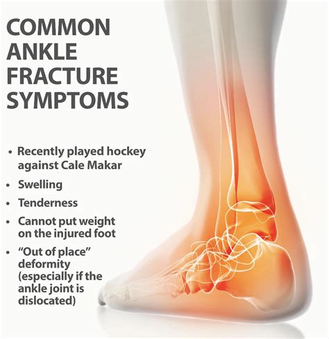 Some important info about common ankle injuries. : r/ColoradoAvalanche