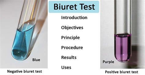 Biuret Test for Protein- Definition, Principle, Procedure, Results, Uses