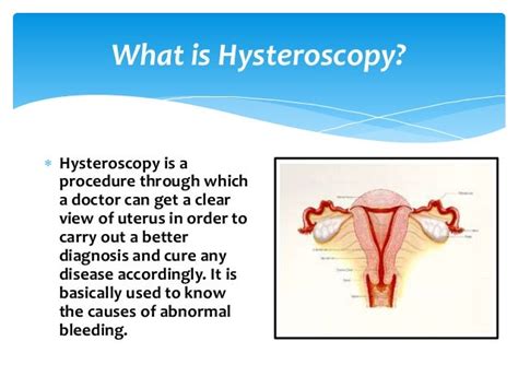 What is Hysteroscopy?