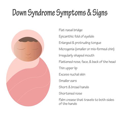 Down Syndrome Symptoms and Signs in Newborns 8131476 Vector Art at Vecteezy