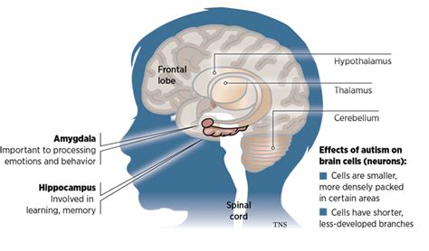 Autism and Epilepsy - The Defeating Epilepsy Foundation