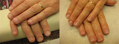 Fix Nail Biting Using OPI Axxium Soak Off Gel | Rainbow Nails' Blog