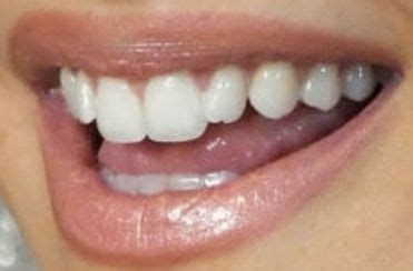 Ariana Grande Teeth Pictures