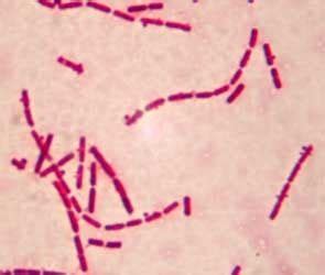 Bacillus Stearothermophilus Gram Stain