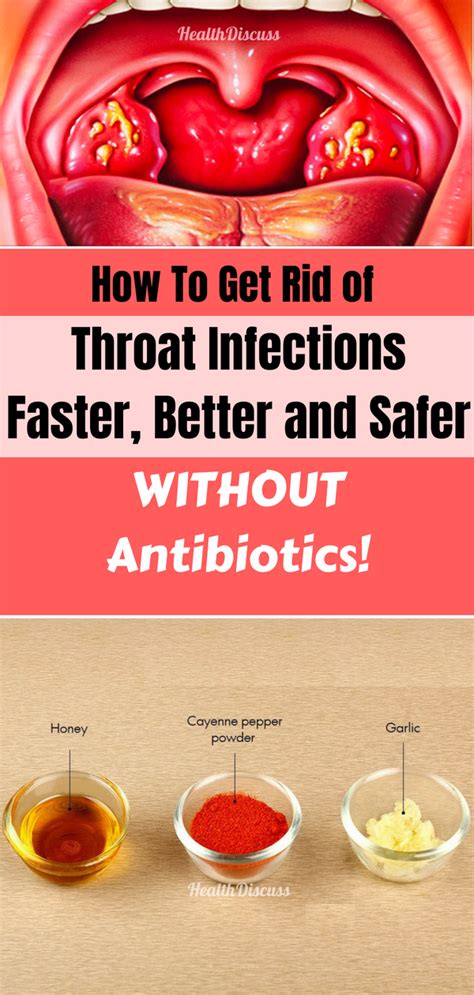How To Get Rid of Throat Infections Faster, Better and Safer, WITHOUT ...