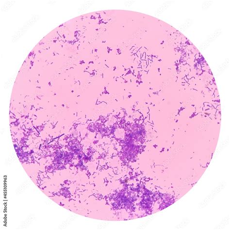 Cocci Bacteria Under Microscope