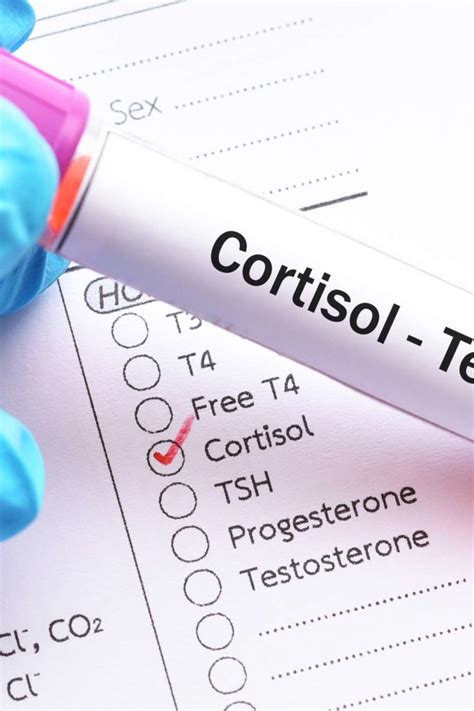 Cortisol level test: Purpose, procedure, and results