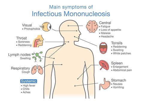 Medical Report: Mononucleosis among most common viruses