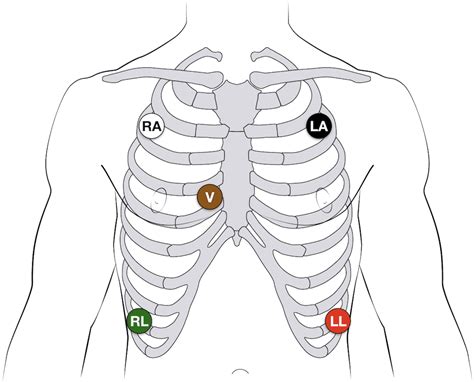 Pin on Cardiac