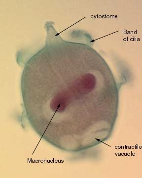 Didinium Paramecium